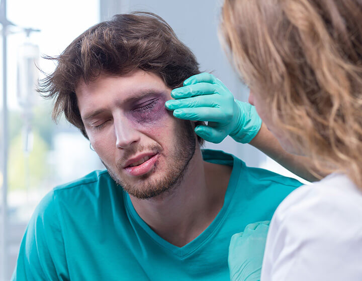 Man with black eye being treated by Family Vision Optical doctor
